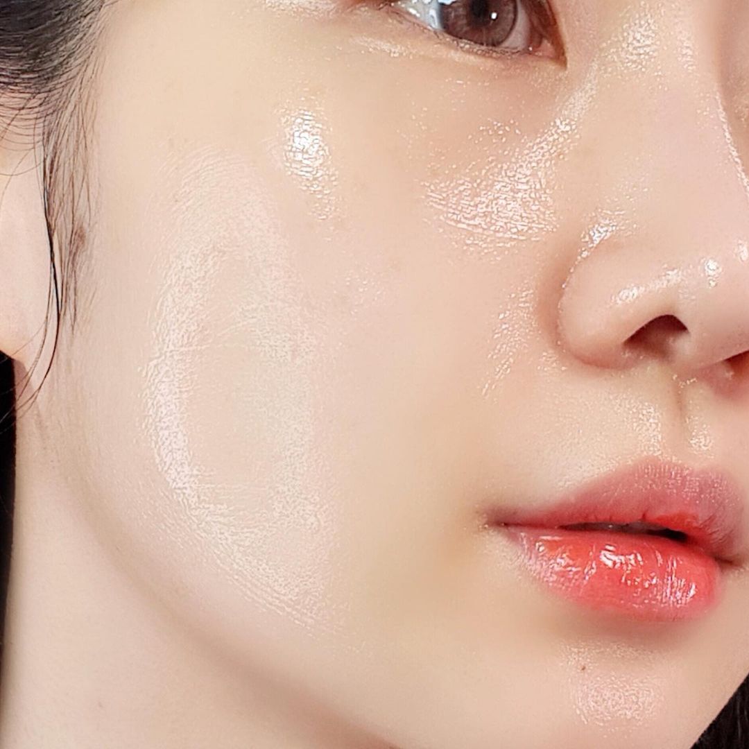 Cấy căng bóng collagen tại Hera Beauty